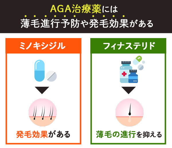 AGA治療薬には2種類ある