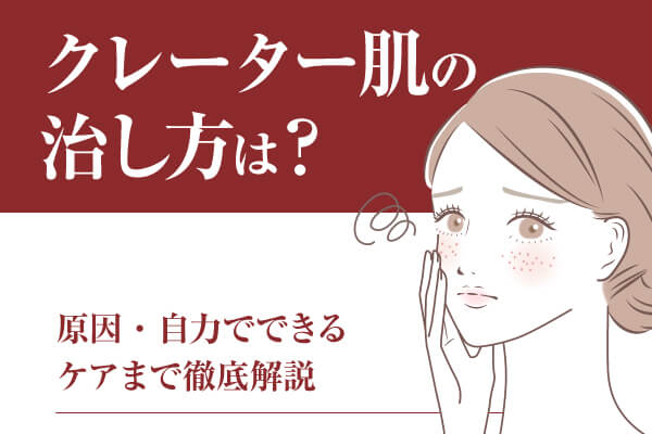 クレーター肌の治し方は？原因・自力でできるケアまで徹底解説