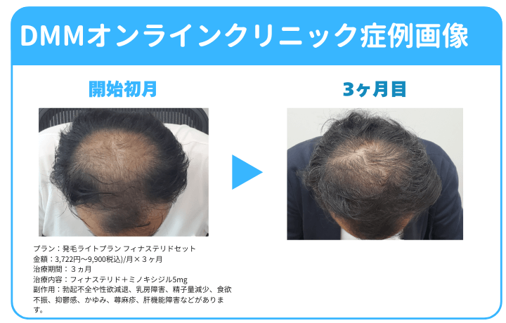 DMMオンラインクリニックの症例画像