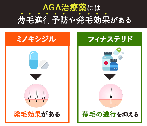 AGA治療薬の種類