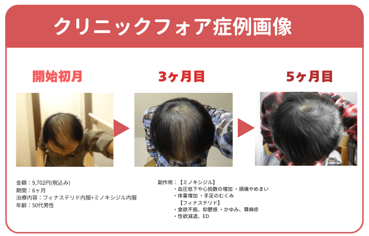 クリニックフォアの症例画像