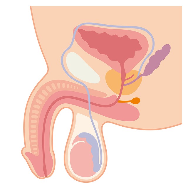 睾丸摘出・陰嚢切除とは