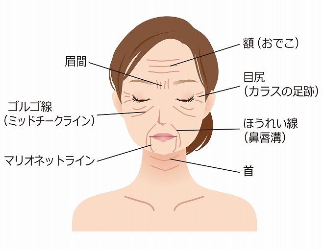 しわの種類と治療方法